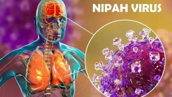 Bộ Y tế hướng dẫn giám sát và phòng bệnh do virus Nipah ở người